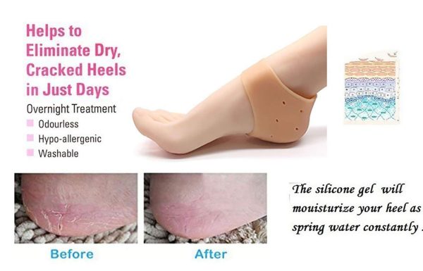 Silicone Anti-Crack Half Heel Socks Set - AVORA
